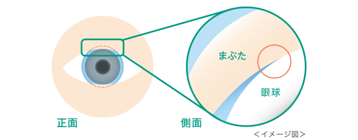 インフィニティ・エッジ® デザイン